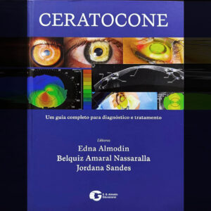 Ceratocone